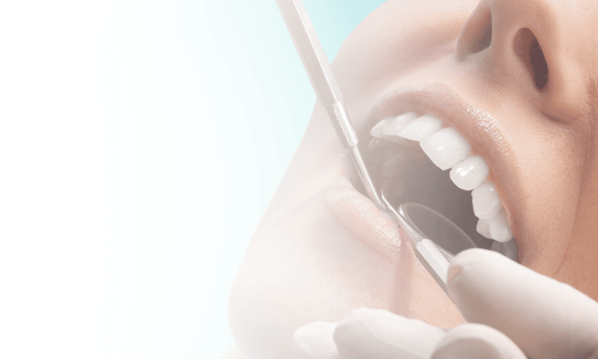 Difference Between Teeth Cleaning and Whitening