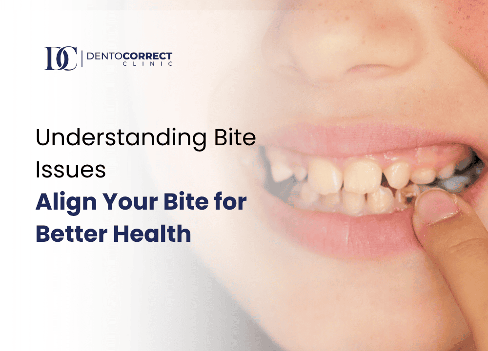 Understanding Bite Issues Align Your Bite for Better Health