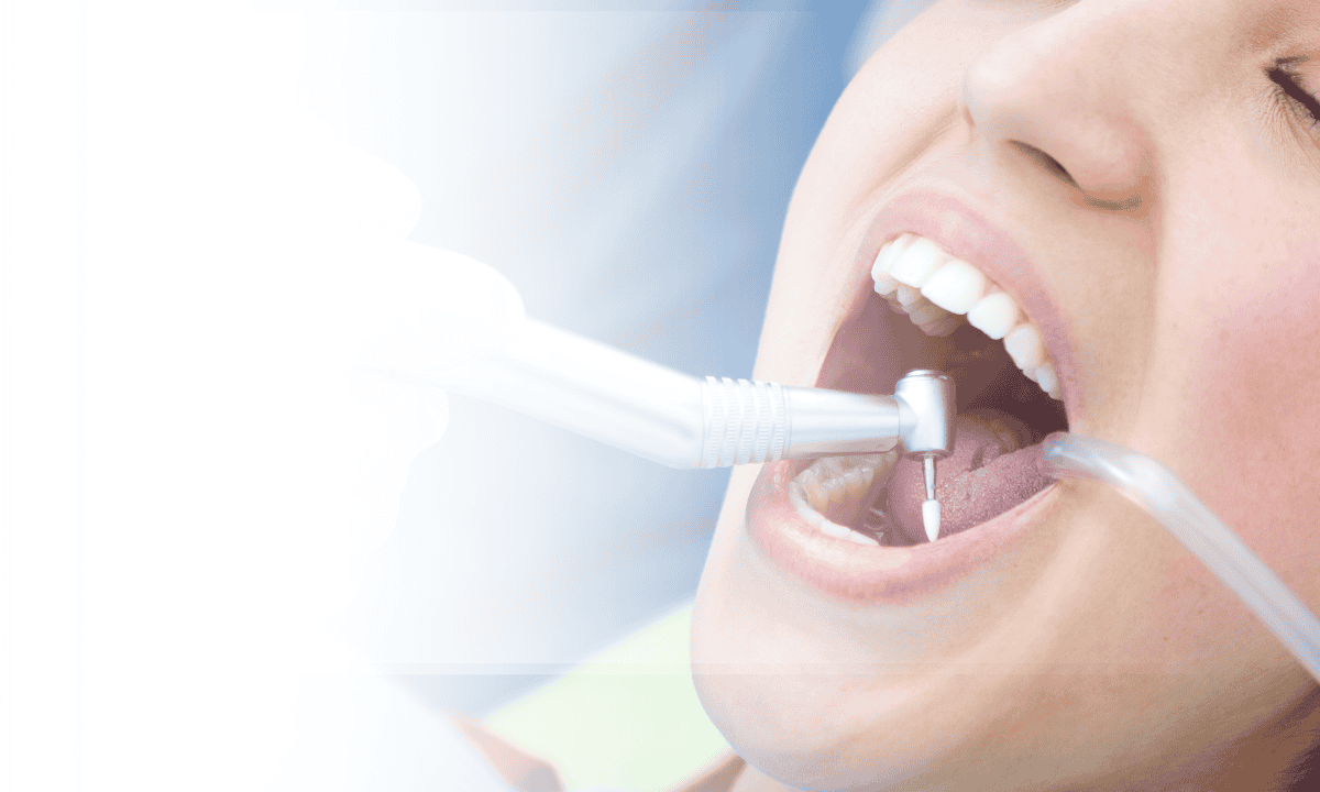 Does Scaling Damage Teeth?