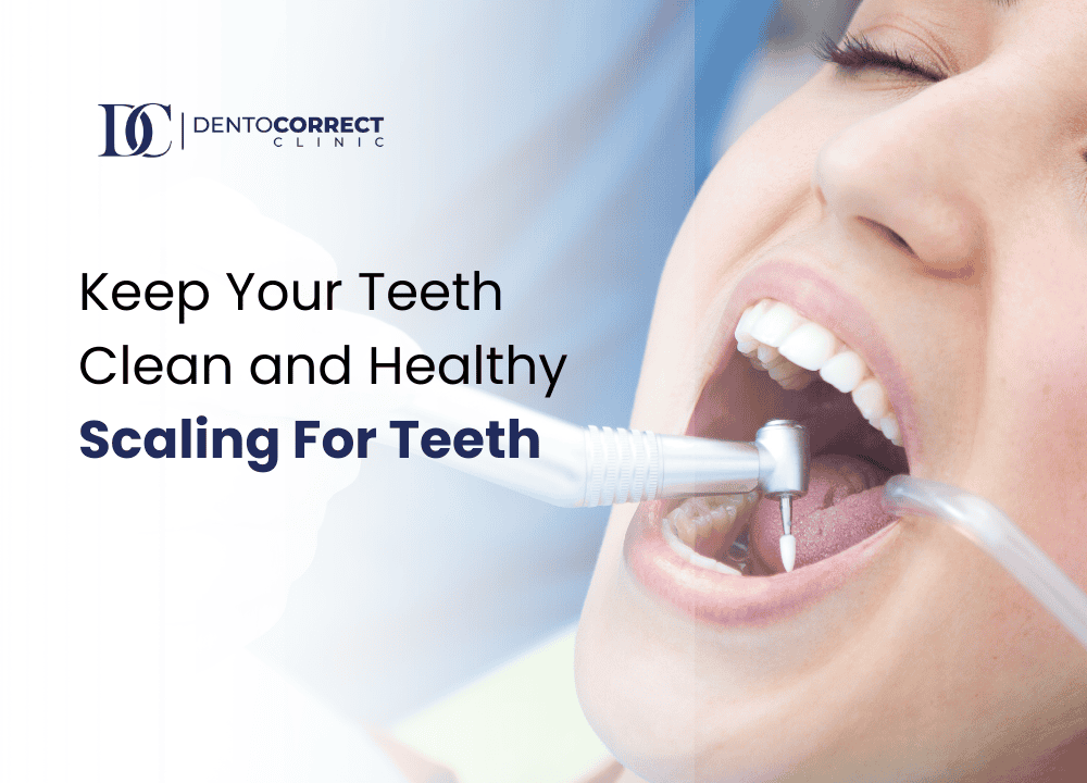 Keep Your Teeth Clean and Healthy Scaling For Teeth