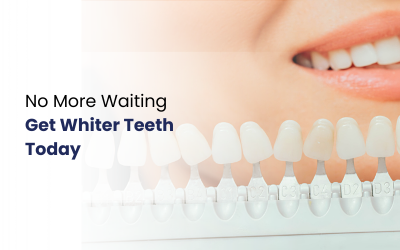 In-Clinic vs At-Home Teeth Whitening