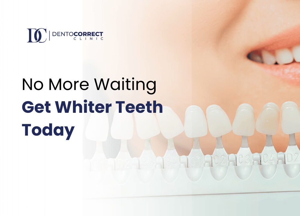 No More Waiting: Get Whiter Teeth Today