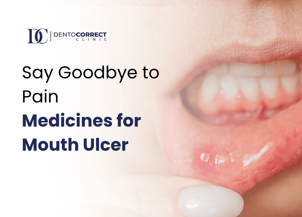 Say Goodbye to Pain: Medicines for Mouth Ulcer