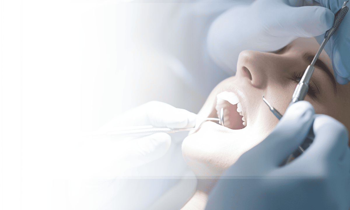 Myths About RCT: Misconceptions About Root Canal