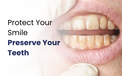 What Are the Different Types of Tooth Wear?