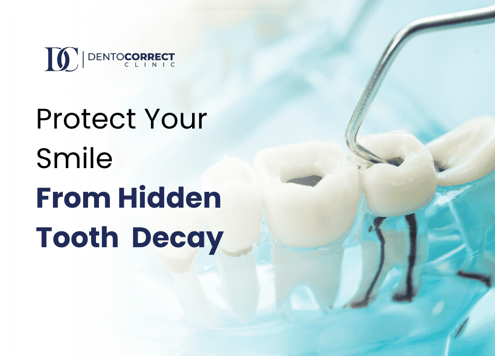 Protect Your Smile — From Hidden Tooth Decay