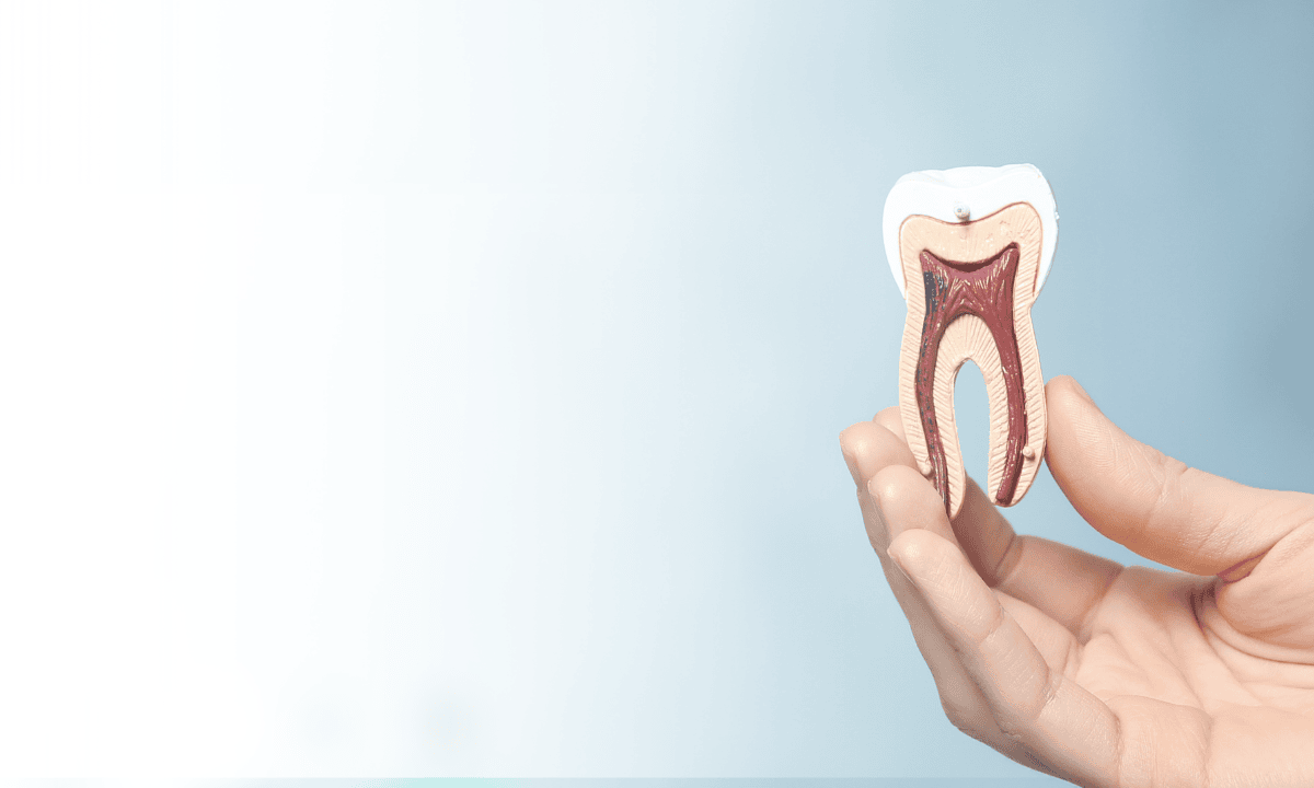Wisdom Tooth Pain: Causes, Symptoms, and Effective Treatments