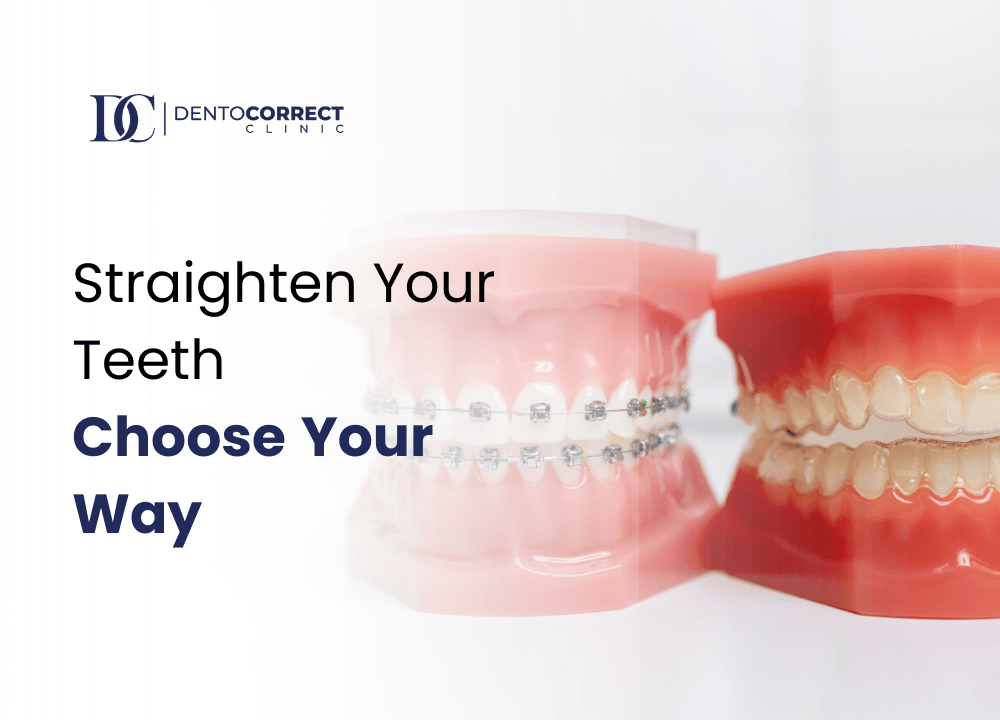 Straighten Your Teeth Choose Your Way