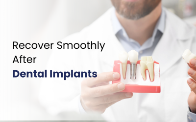How to Relieve Pain from a Dental Implant