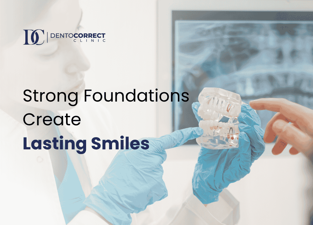 What is Bone Grafting