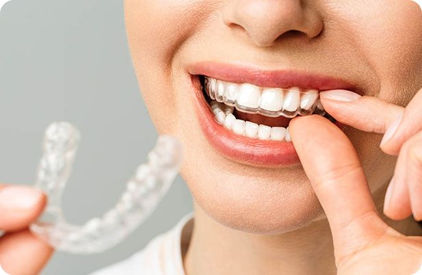 Patient fitting a clear aligner tray at DentoCorrect