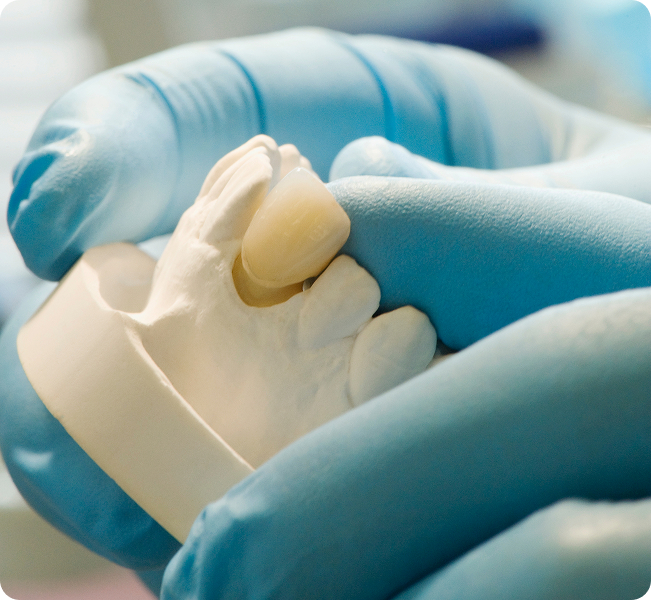 Types of dental crowns at DentoCorrect