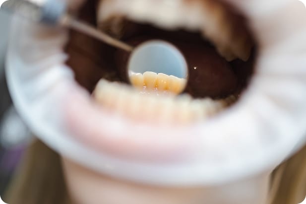 Teeth whitening clinical examination at DentoCorrect