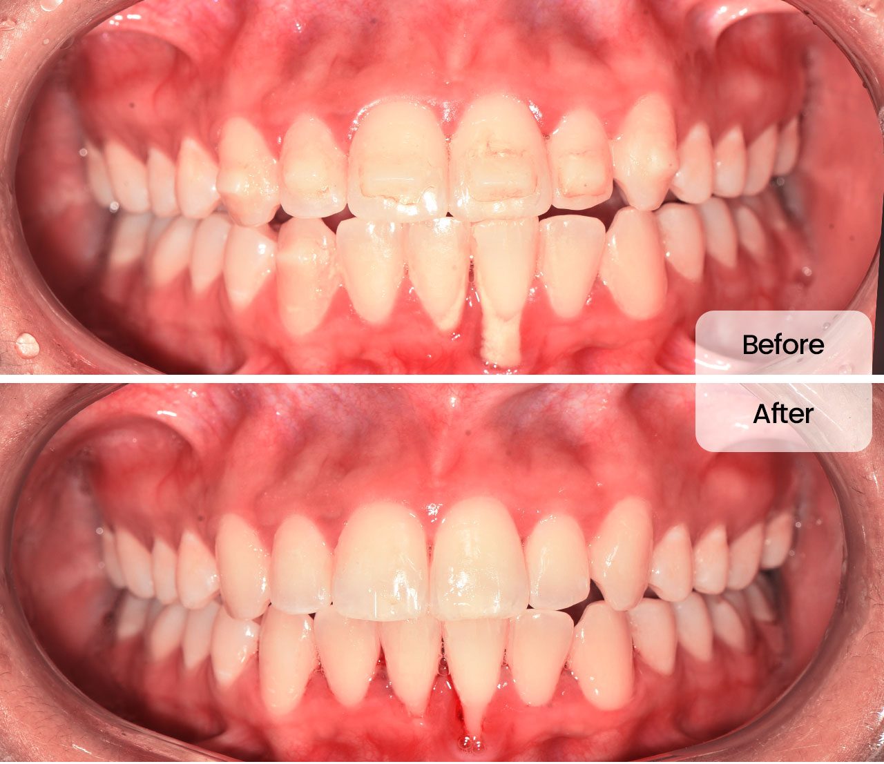 scaling before after