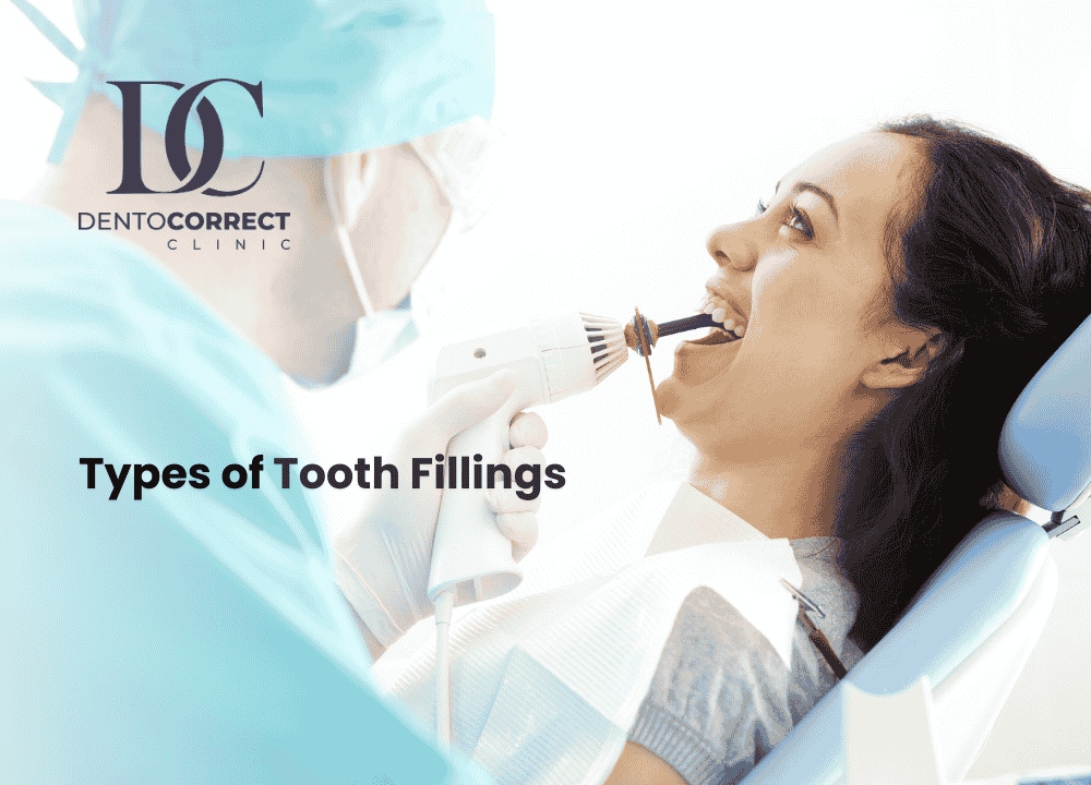 Read more about the article Different Types of Tooth Fillings