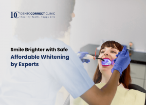 Read more about the article Affordable Teeth Whitening