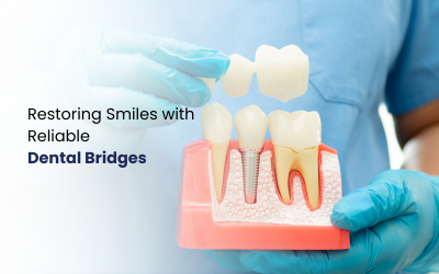 Dental Bridge