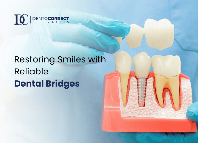 Step by Step Guide to Dental Bridge Placement-2