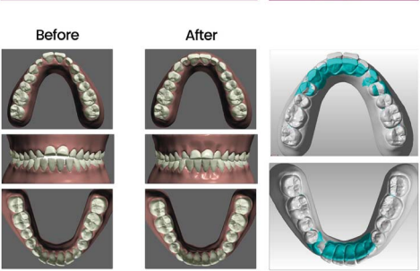A difference between the before and after of a success story.