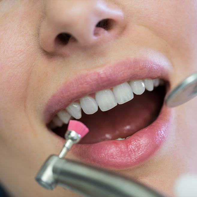 A girl in front of the dentist is getting scaling and polishing treatment.