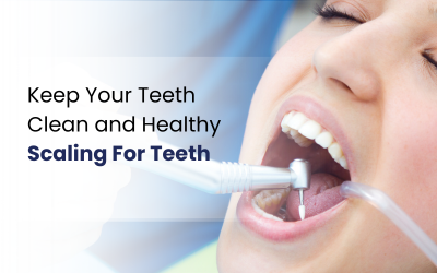 Girl search for scaling and polishing near me and get the treatment.