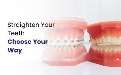 Straight your teeth with clear aligner and braces.