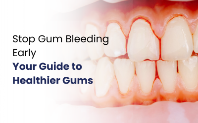 A patient is getting bleeding gums treatments.