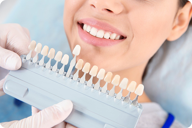 Teeth whitening shades have been shown to provide an accurate whitening result.