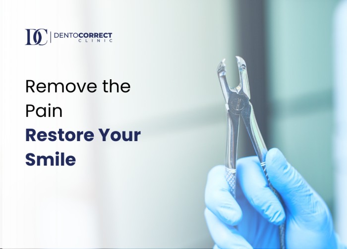 Wisdom Tooth Extraction